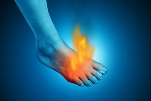 Causes of Burning Feet While Running